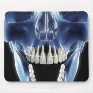 X-ray style look at human teeth mouse pad
