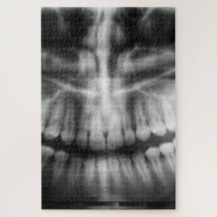 X-Ray Teeth Mouth Smile Black and White Jigsaw Puzzle