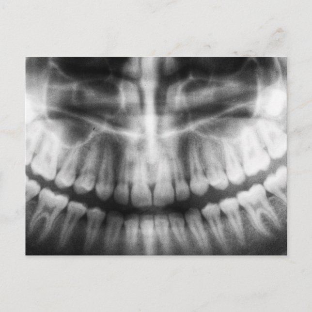 X-Ray Teeth Mouth Smile Black and White Postcard (Front)