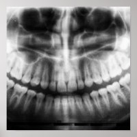 X-Ray Teeth Mouth Smile Black and White
