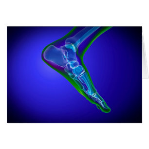 X-Ray View Of Human Foot 1