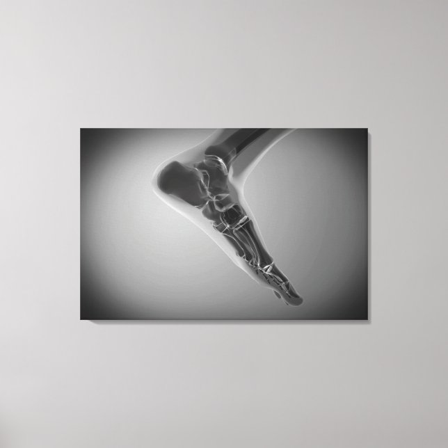 X-Ray View Of Human Foot 4 Canvas Print (Front)