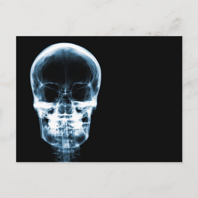 X-RAY VISION SKELETON SKULL - BLUE POSTCARD (Front)