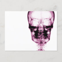 X-Ray Vision Skeleton Skull - Pink