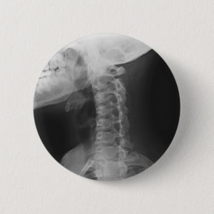 X-rayed 2 6 cm round badge