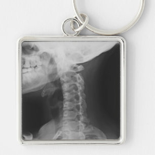 X-rayed 2 key ring