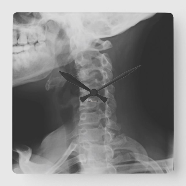 X-rayed 2 square wall clock (Front)
