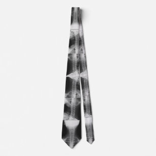 X-rayed 2 tie