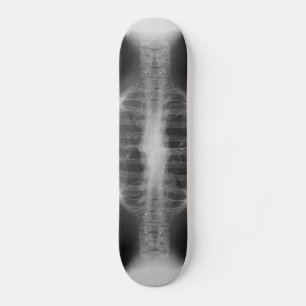 X-rayed 3 skateboard