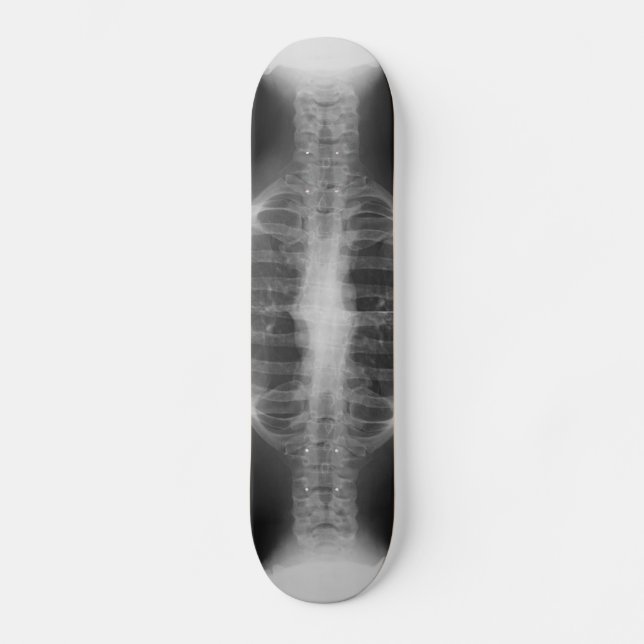 X-rayed 3 skateboard (Front)