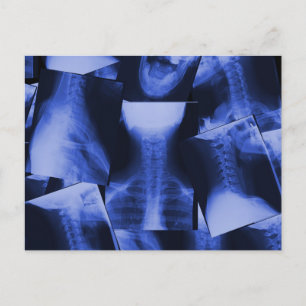 X-rayed - Electromagnetic Blue Postcard