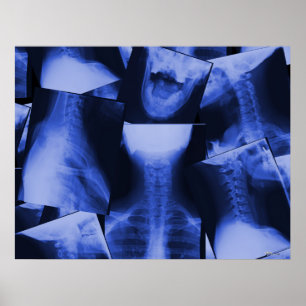 X-rayed - Electromagnetic Blue Poster