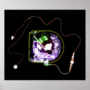 XRAY DISCMAN POSTER