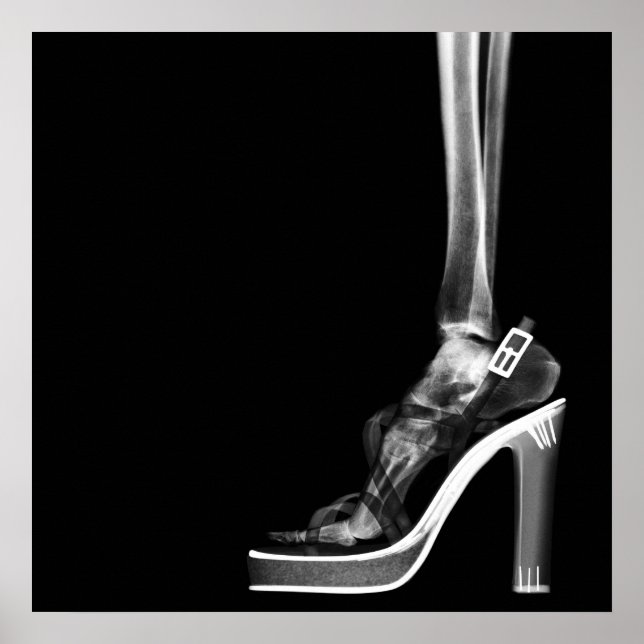XRAY HIGH HEEL LADY SKELETON FOOT B&W POSTER (Front)