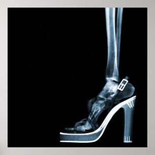 XRAY HIGH HEEL LADY SKELETON FOOT  BLUE POSTER