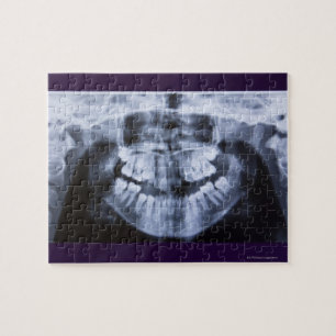Xray of a girls jawline taken with a panoramic jigsaw puzzle