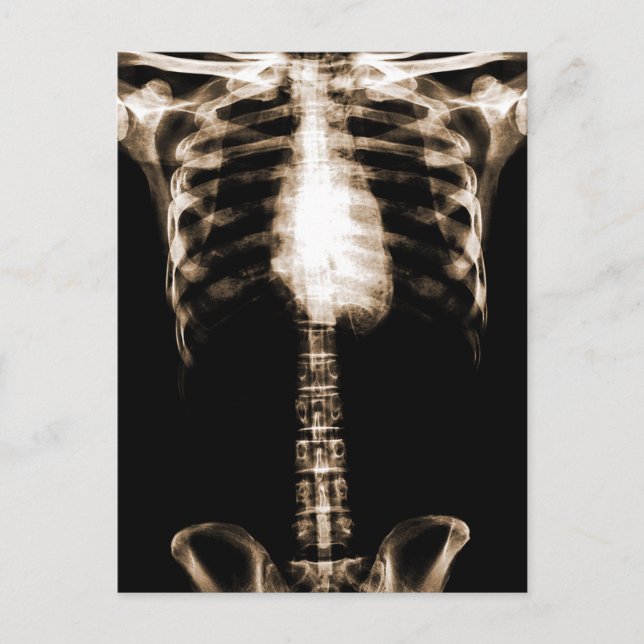 XRAY SKELETON TORSO RIBS SEPIA POSTCARD (Front)