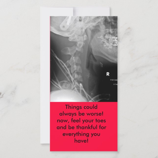 xray, Things could always be worse! now, feel y... Thank You Card (Front)
