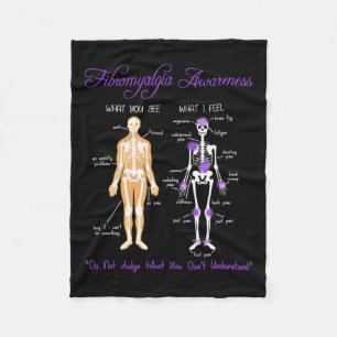 You See What I Feel Skeleton Fibromyalgia Awarenes Fleece Blanket